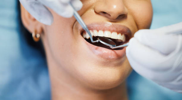 Best Dental Abscess Treatment in Laurel, MD