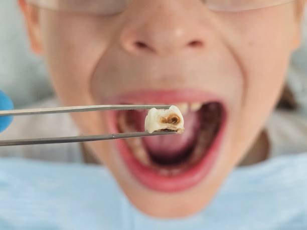 Professional Emergency Dental Service in MD